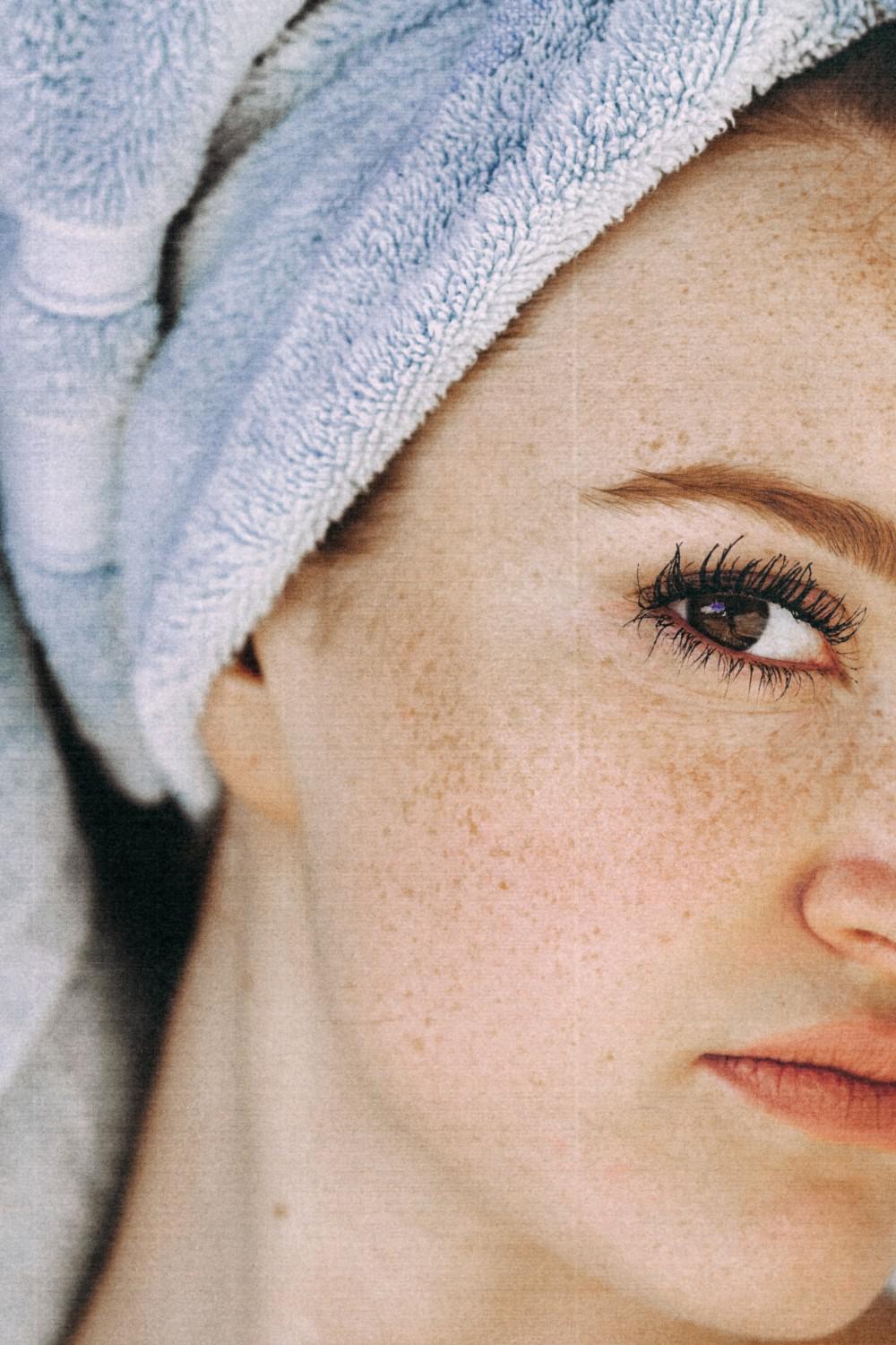 Why You Shouldn’t Try Microneedling at Home