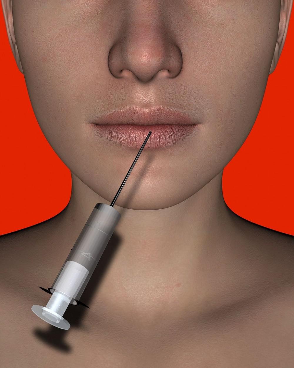 rendering of a syringe injecting botox into lips