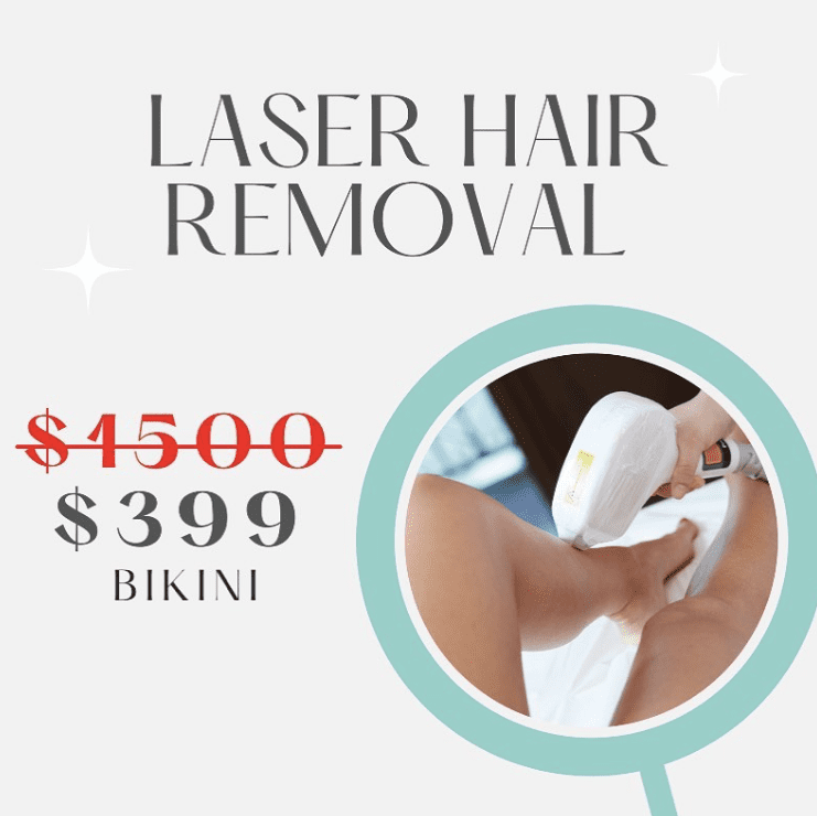 laser hair removal for $399