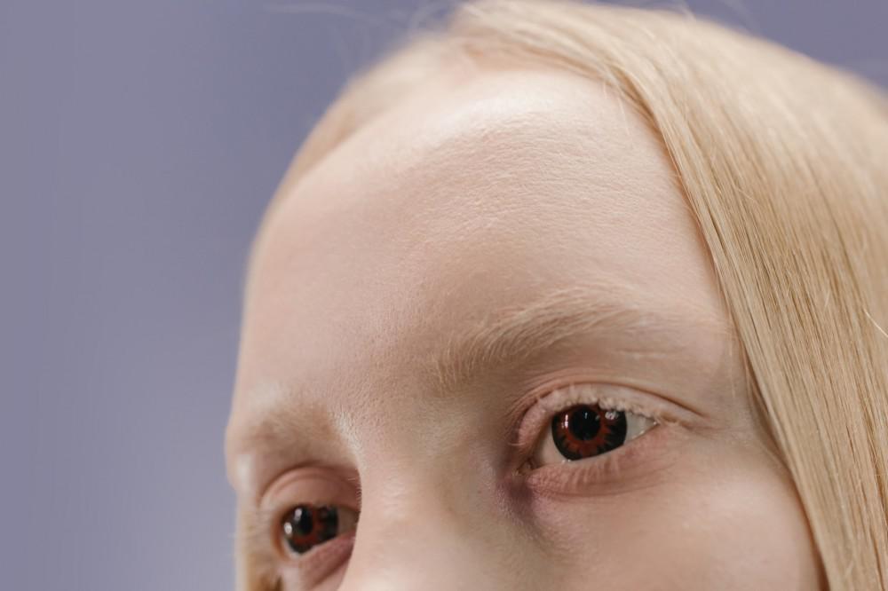 closeup of a woman's forehead
