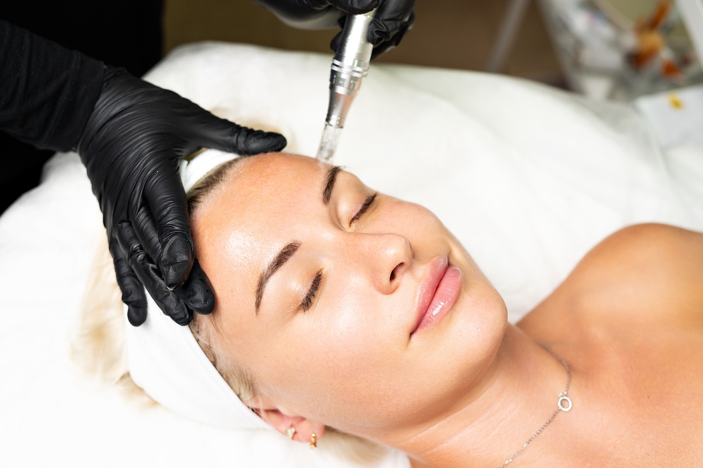 Woman laying down with eyes closed, a close up of her face. A hand wearing a block glove holds her skin in place, with the other hand administering microneedling treatment.